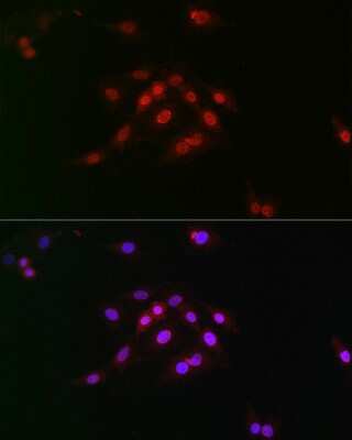 Immunocytochemistry/Immunofluorescence: Cyclin E1 [p Thr395] Antibody [NBP3-05378] - Immunofluorescence analysis of C6 cells using Cyclin E1 Rabbit pAb (NBP3-05378) at dilution of 1:100 (40x lens). Blue: DAPI for nuclear staining.